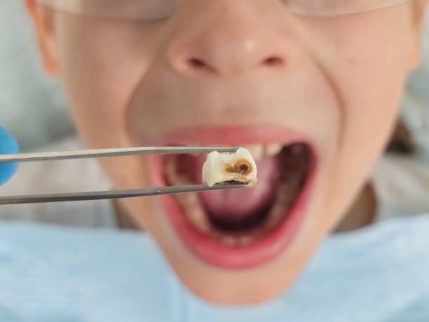 Best Emergency Cosmetic Dentistry in West Long Branch, NJ